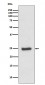 ZNRF2 Antibody